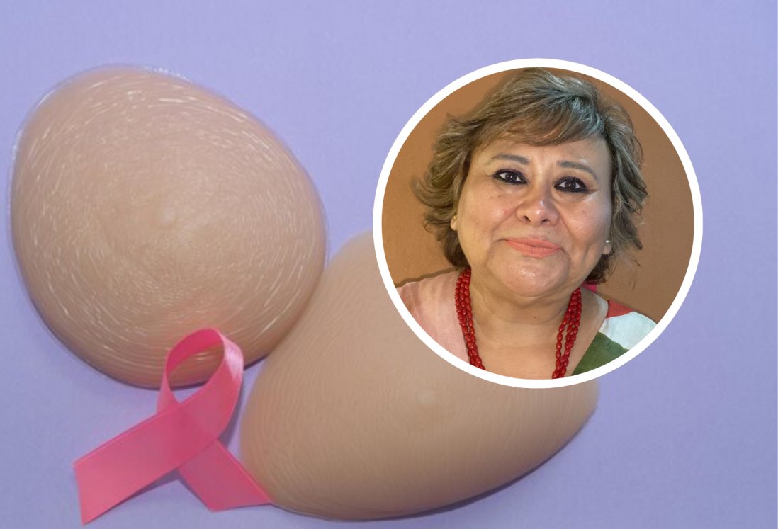 En este lugar de Veracruz donarán prótesis mamarias y brassieres para sobrevivientes de cáncer