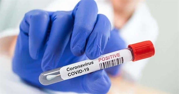 Covid-19: ¿cuántos días debes usar el cubrebocas tras superar el contagio?