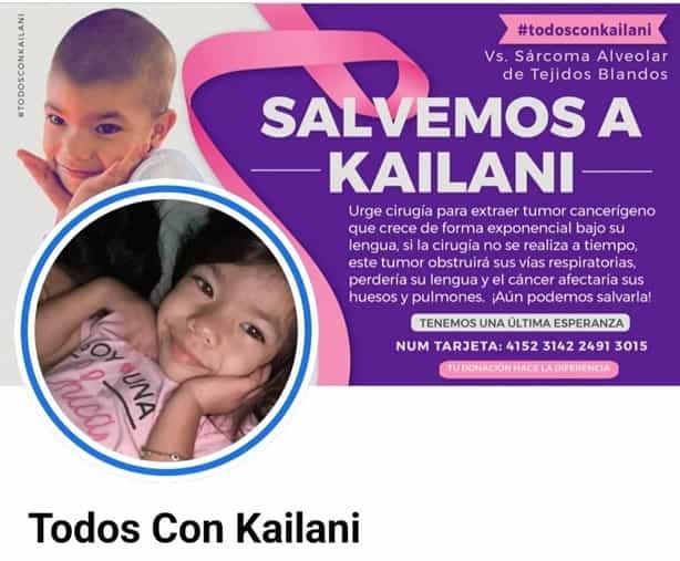 Familiares de Kai, pequeña con cáncer de lengua, hacen anuncio sobre su cirugía; aún puedes ayudar