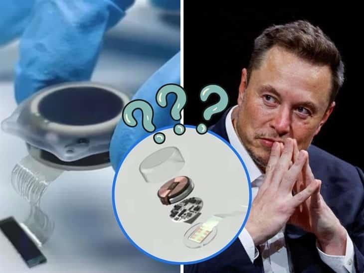 Chip cerebral de Elon Musk: ¿Cuáles son sus funciones y para qué sirve? 