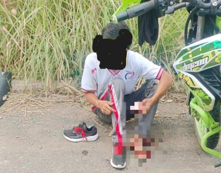 Estudiante del Tebaev resulta lesionado tras sufrir aparatosa caída en motocicleta