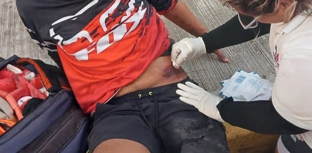 Dos jóvenes de Úrsulo Galván terminan en hospital tras derrapar en motocicleta