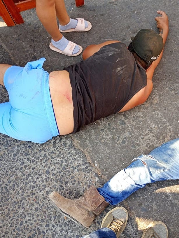 Dos motociclistas en Alvarado chocan y terminan en hospital